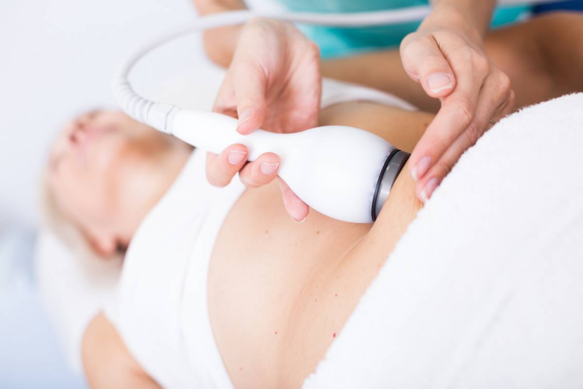 La cryolipolyse fonctionne-t-elle vraiment pour la perte de poids ?