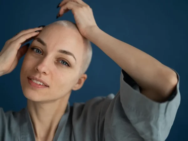 Cheveux clairsemés sur le haut du crâne : causes, solutions et pouvoir d’agir